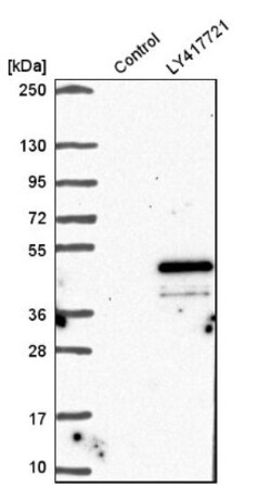 AIM2 Antibody, Novus Biologicals:Antibodies:Primary Antibodies